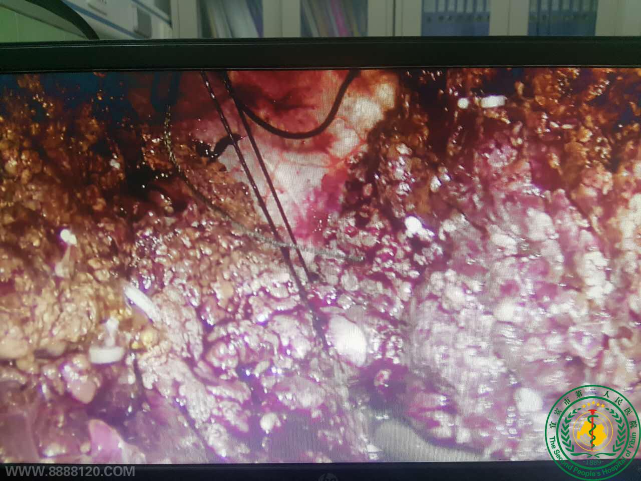 ˱жҽԺε˳˱еһȫǻǰ·׼Ұг