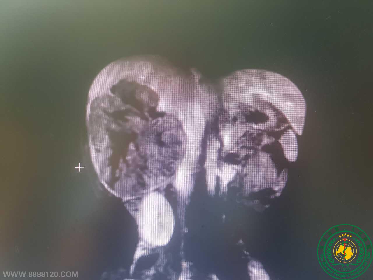 ˱жҽԺε˳˱еһȫǻǰ·׼Ұг