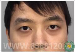 ˱еڶҽԺοƾĵ̡˫Ƥ