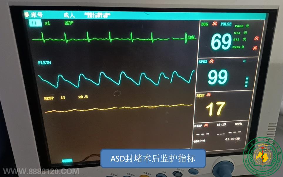 宜宾首例自主非射线经皮房缺封堵术在我院成功开展