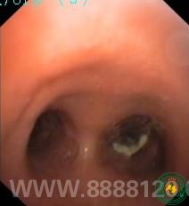 һ֧ܾĳɹǯȡм֧һ