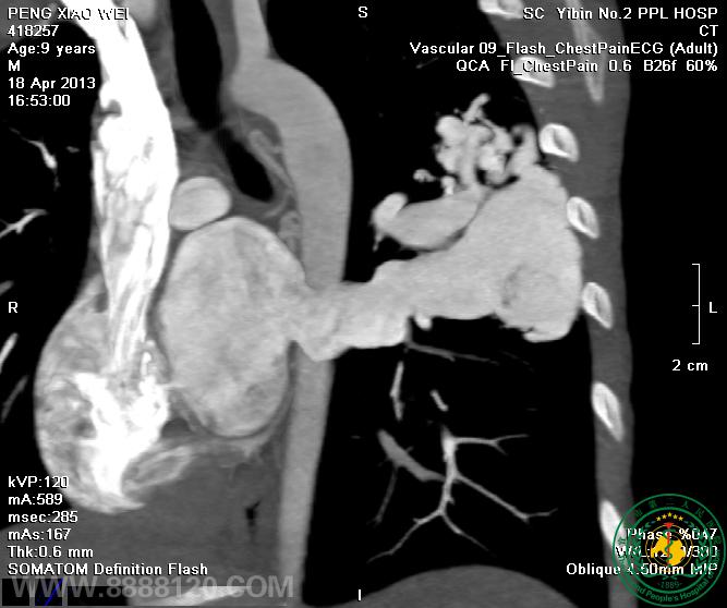 ԺCTƳࡢ״ζһվʽ¼