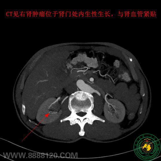 ӭѶϣ츣ߡ˱еڶҽԺ˳һѶг