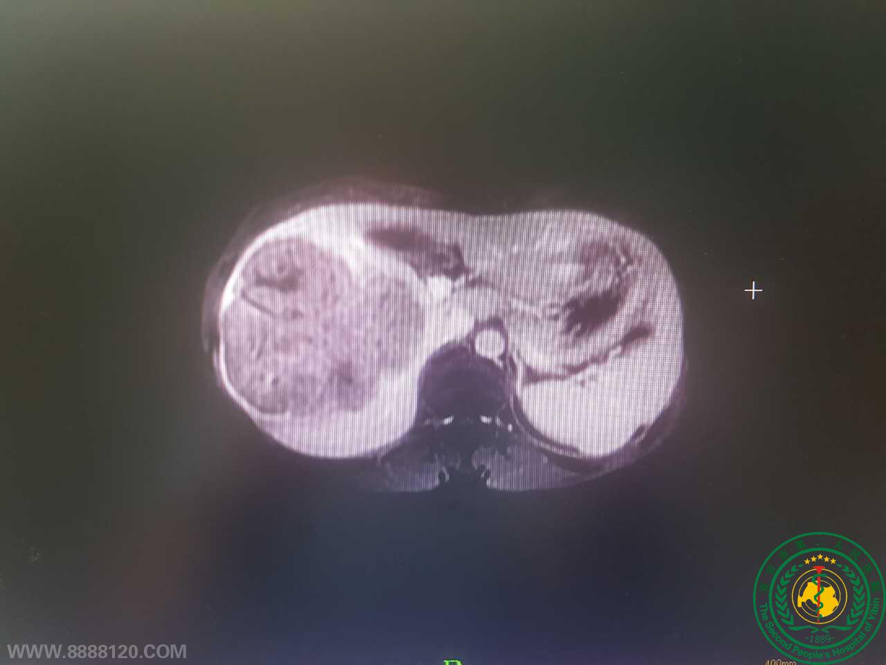 ˱жҽԺε˳˱еһȫǻǰ·׼Ұг