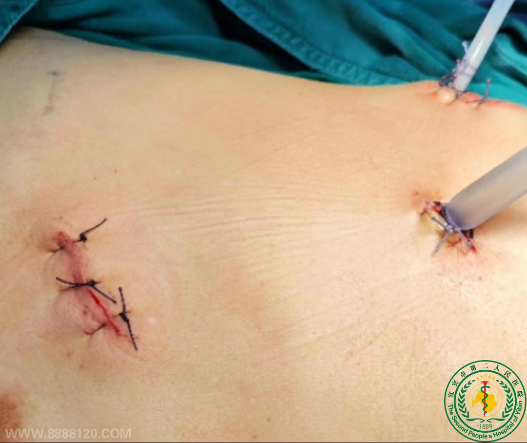 ˱ȫǻʽ·г֧ܳ˱ҽԺɹչ