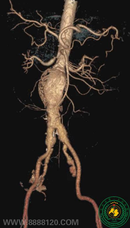 ˱˱ҽԺɹչ3DӡEVAR