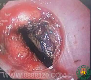 ޱϢ-˼Զ-2019.06.04