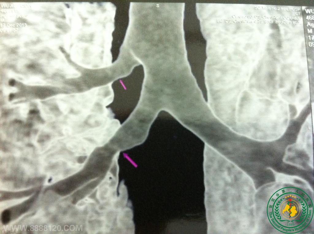 ˱еڶҽԺƳɹһҷҶ֧ȫԱҶ֧ܷ쳣