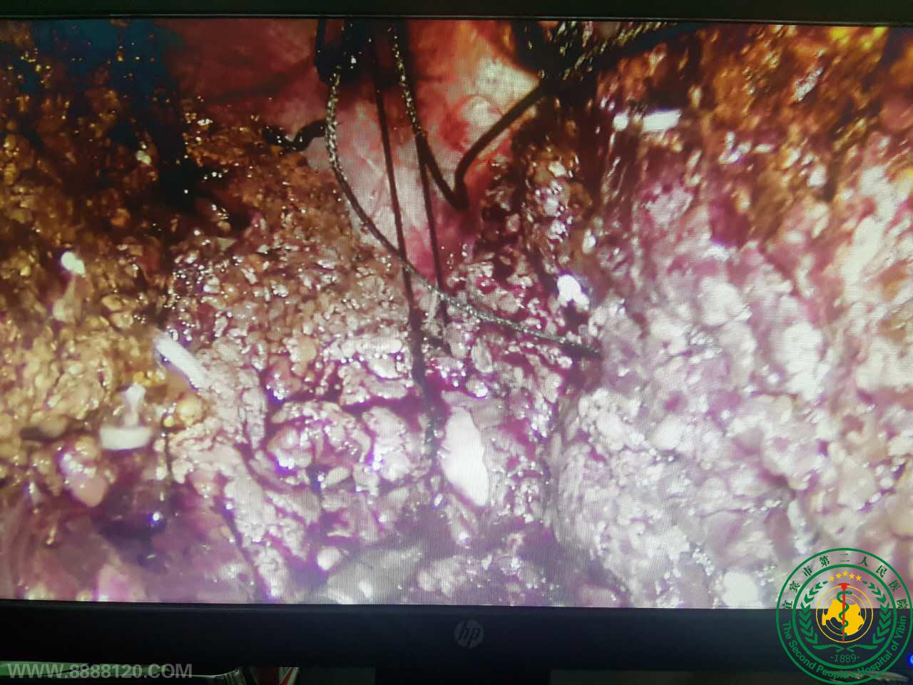 ˱жҽԺε˳˱еһȫǻǰ·׼Ұг