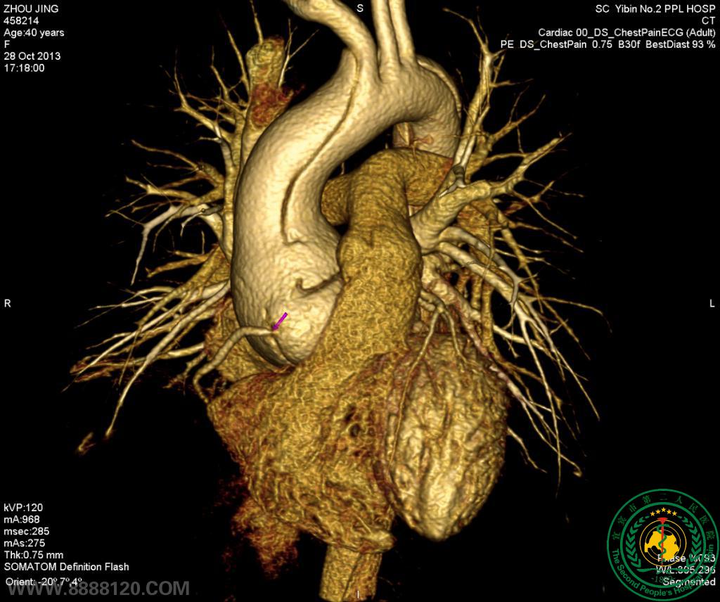 ԺCTƳزѪܣ״ζһվʽ鼼